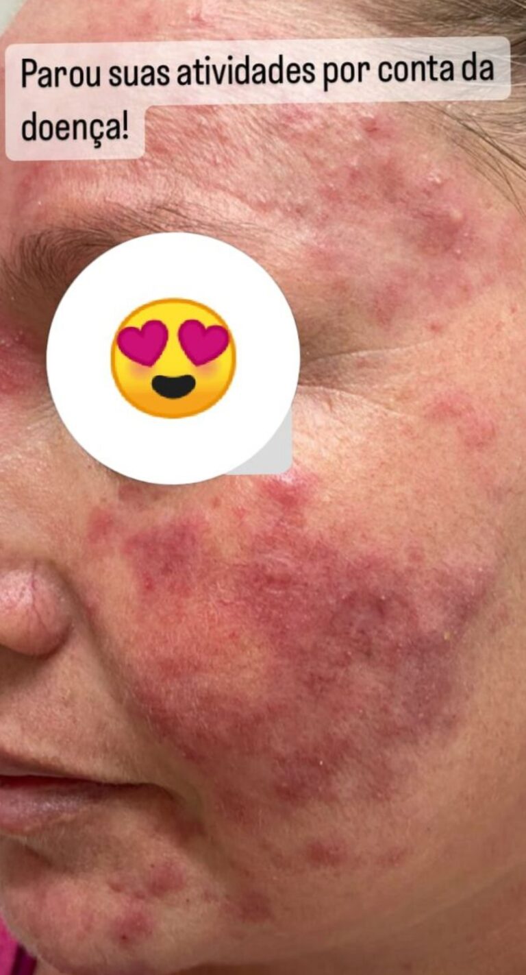 antes e depois_page-0003