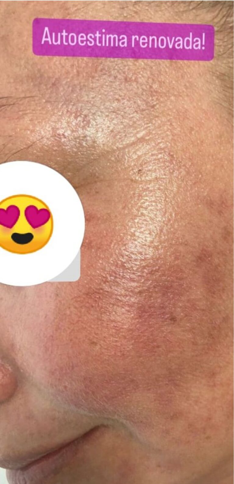 antes e depois_page-0004