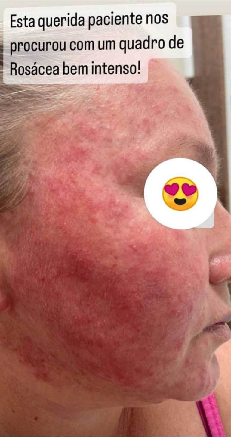 antes e depois_page-0005