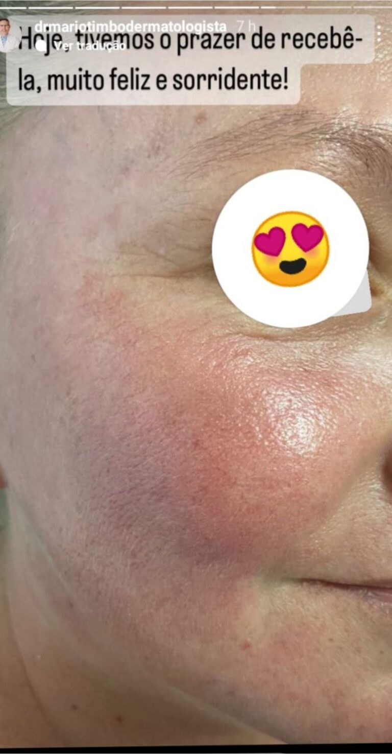 antes e depois_page-0006